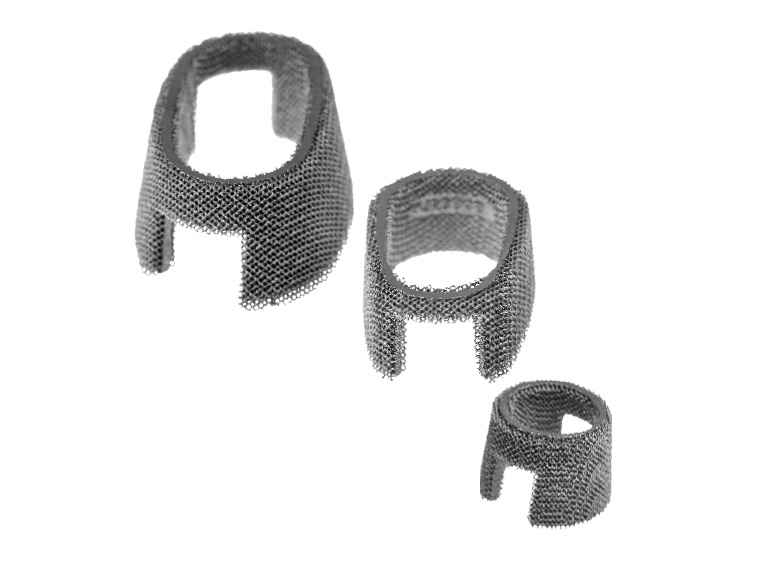 3D Metal Tibial Cones